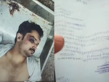 You are currently viewing ग्वालियर के नशामुक्ति केंद्र में PNB अफसर की हत्या: पोस्टमार्टम रिपोर्ट ने खोला राज, शरीर पर 16 चोटें, सिर और पसलियां तोड़ीं; मौत से पहले पत्नी-बेटी से हुई आखिरी मुलाकात!